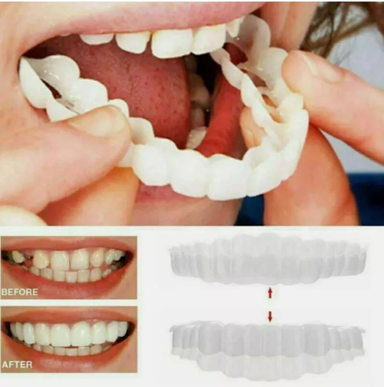 Snap On Smile
