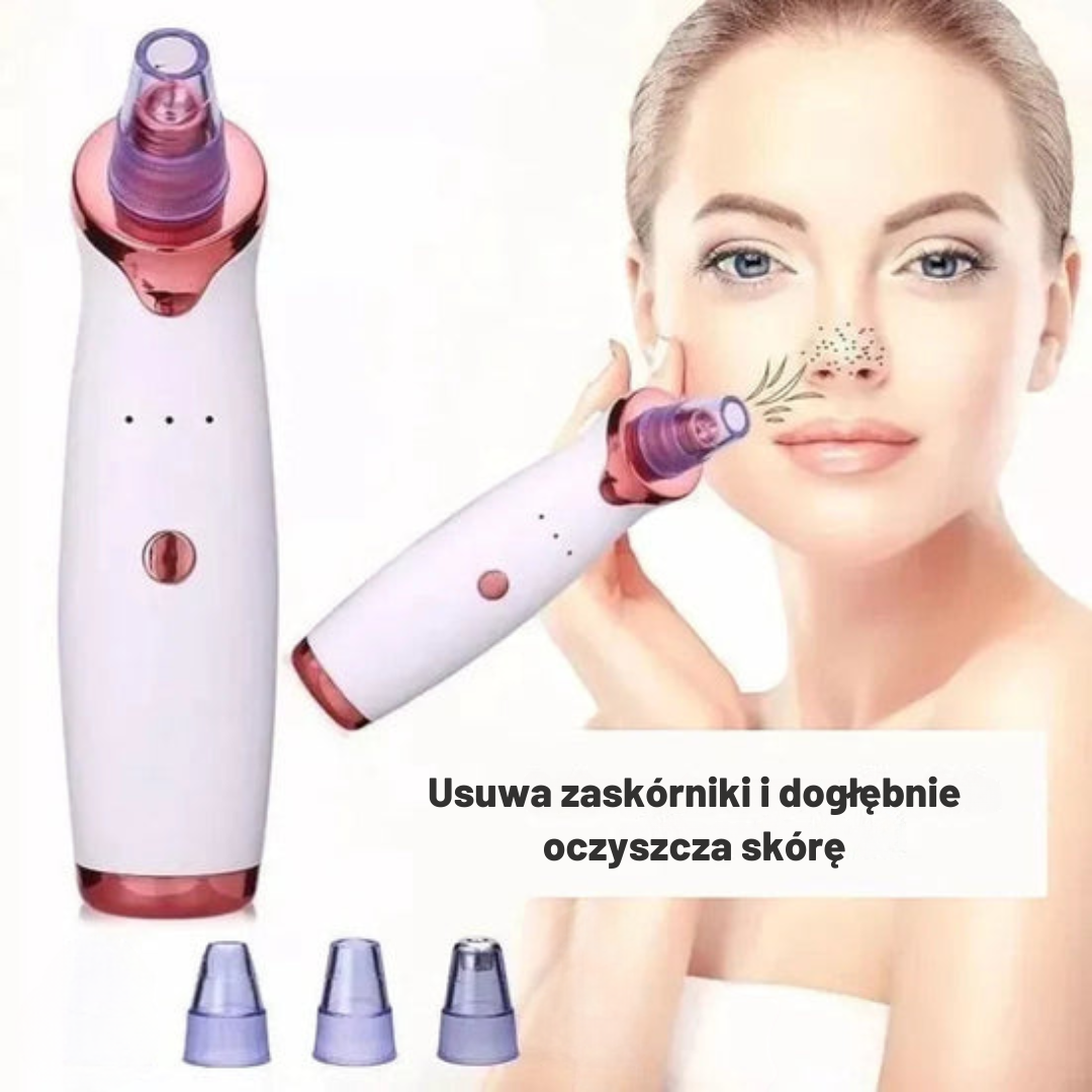 Extractor trądzikowy™ – Skuteczne i bezbolesne oczyszczanie
