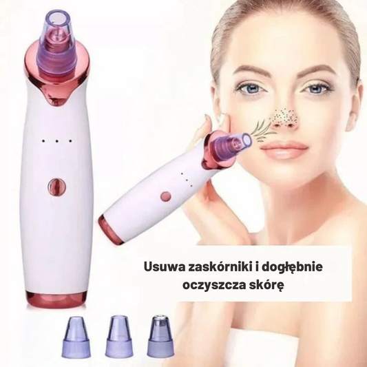 Extractor trądzikowy™ – Skuteczne i bezbolesne oczyszczanie