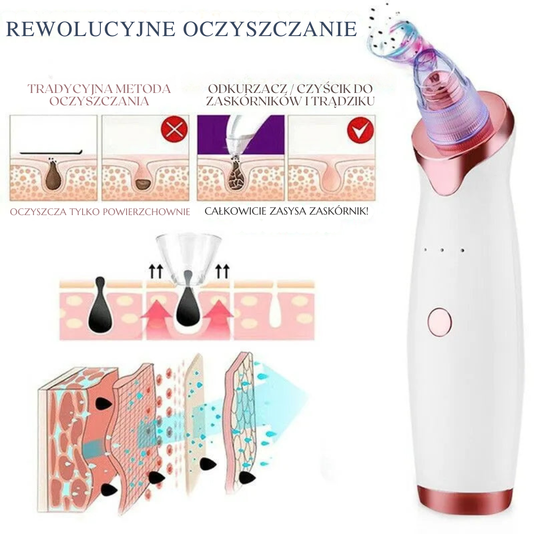 Extractor trądzikowy™ – Skuteczne i bezbolesne oczyszczanie